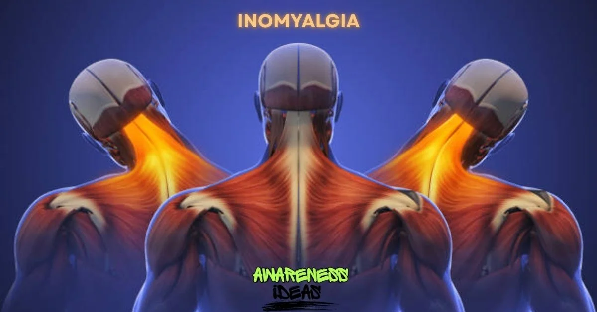 inomyalgia