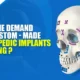 Orthopedic Implants