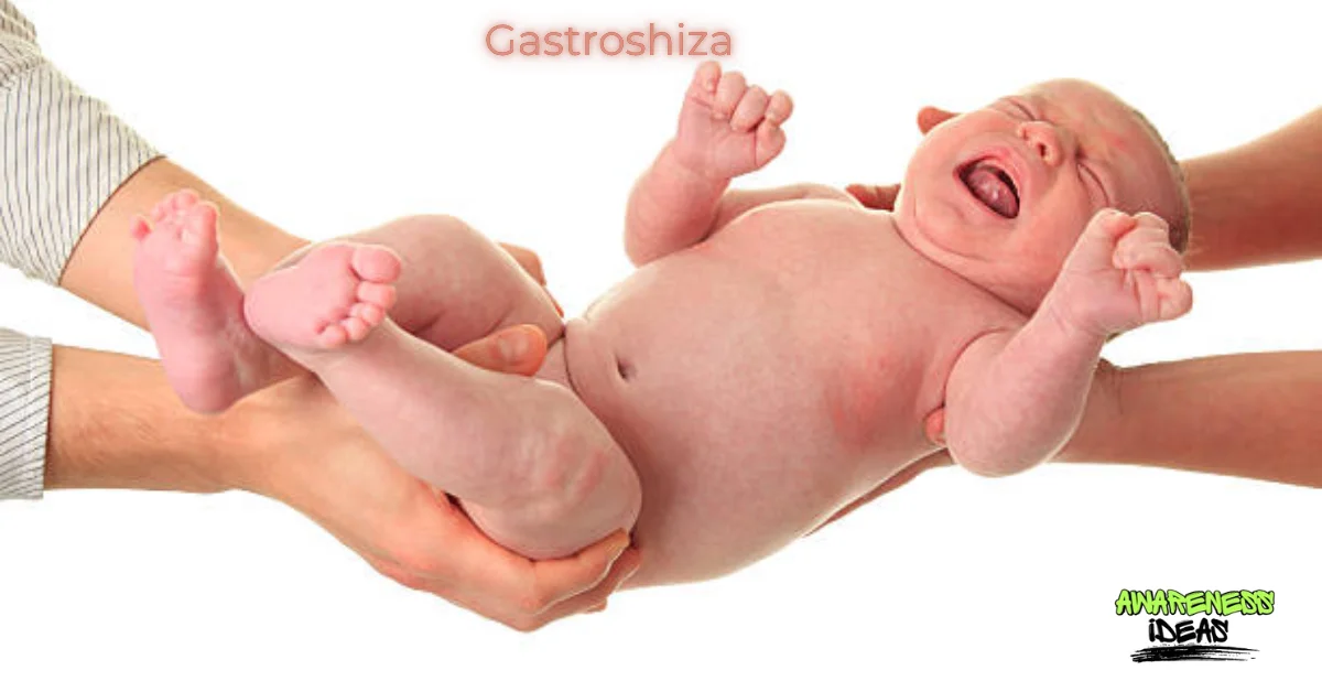 gastroshiza
