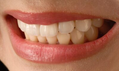 Confident Smile Branding: Dental Enhancements That Elevate Image