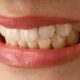 Confident Smile Branding: Dental Enhancements That Elevate Image