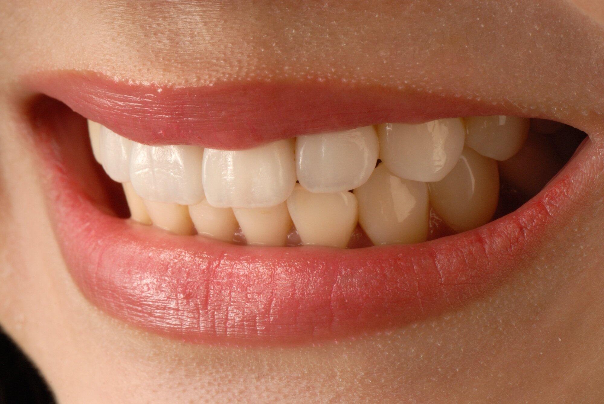 Confident Smile Branding: Dental Enhancements That Elevate Image