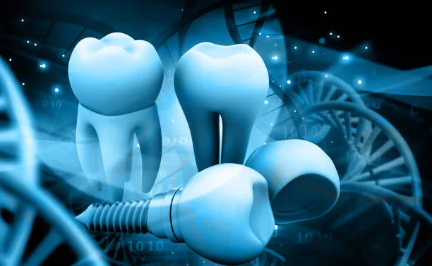 dental implants