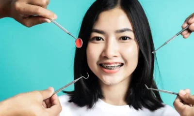 Smile Makeover
