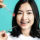 Smile Makeover