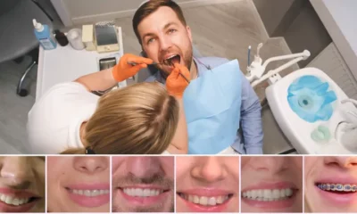 cosmetic dentistry myths