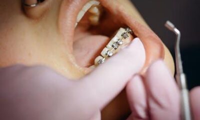 The Impact of Orthodontic Health on Children's Growth