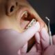 The Impact of Orthodontic Health on Children's Growth