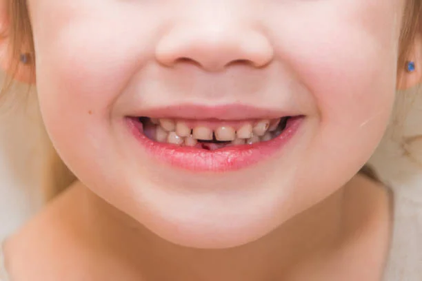 baby teeth to permanent teeth