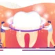 preventive dental care