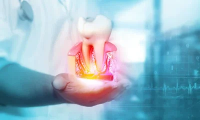 periodontal treatment