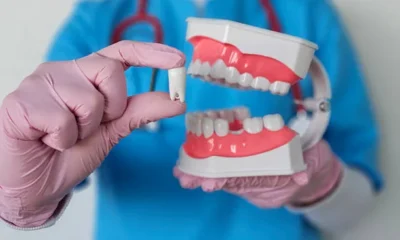 cosmetic dental work