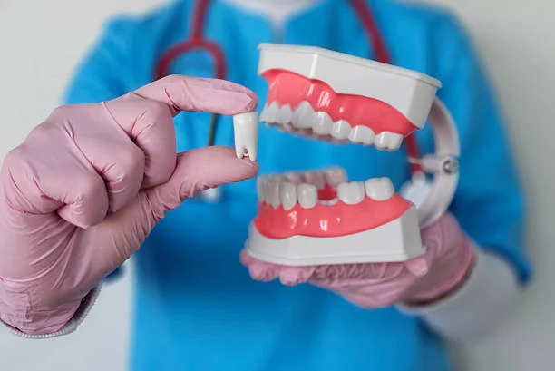 cosmetic dental work